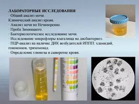 Общий анализ мочи (форма 210/у)